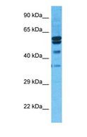 PRDM12 Antibody - Western blot of PRD12 Antibody with human Fetal Liver lysate.  This image was taken for the unconjugated form of this product. Other forms have not been tested.