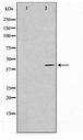 PRDM12 Antibody - Western blot of HUVEC cell lysate using PRDM12 Antibody