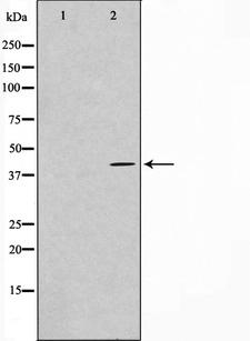 PRDM12 Antibody - Western blot analysis on HuvEc cell lysates using PRDM12 antibody. The lane on the left is treated with the antigen-specific peptide.