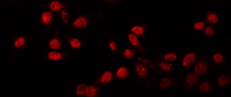 PRDM12 Antibody - Staining HuvEc cells by IF/ICC. The samples were fixed with PFA and permeabilized in 0.1% Triton X-100, then blocked in 10% serum for 45 min at 25°C. The primary antibody was diluted at 1:200 and incubated with the sample for 1 hour at 37°C. An Alexa Fluor 594 conjugated goat anti-rabbit IgG (H+L) Ab, diluted at 1/600, was used as the secondary antibody.