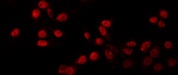 PRDM12 Antibody - Staining HuvEc cells by IF/ICC. The samples were fixed with PFA and permeabilized in 0.1% Triton X-100, then blocked in 10% serum for 45 min at 25°C. The primary antibody was diluted at 1:200 and incubated with the sample for 1 hour at 37°C. An Alexa Fluor 594 conjugated goat anti-rabbit IgG (H+L) Ab, diluted at 1/600, was used as the secondary antibody.