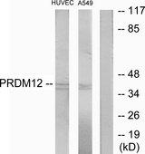 PRDM12 Antibody - Western blot analysis of extracts from HUVEC cells and A549 cells, using PRDM12 antibody.