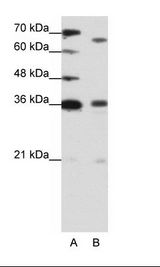 PRDM13 Antibody - A: Marker, B: Jurkat Cell Lysate.  This image was taken for the unconjugated form of this product. Other forms have not been tested.