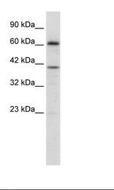PRDM14 Antibody - Jurkat Cell Lysate.  This image was taken for the unconjugated form of this product. Other forms have not been tested.