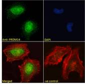 PRDM14 Antibody - Goat Anti-PRDM14 (aa414-427) Antibody Immunofluorescence analysis of paraformaldehyde fixed HeLa cells, permeabilized with 0.15% Triton. Primary incubation 1hr (10ug/ml) followed by Alexa Fluor 488 secondary antibody (2ug/ml), showing nuclear staining. Actin filaments were stained with phalloidin (red) and the nuclear stain is DAPI (blue). Negative control: Unimmunized goat IgG (10ug/ml) followed by Alexa Fluor 488 secondary antibody (2ug/ml).