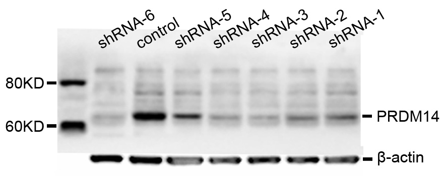 PRDM14 Antibody - Western blot analysis of various groups from PA-1 cells.