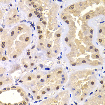 PRDM14 Antibody - Immunohistochemistry of paraffin-embedded human kidney tissue.