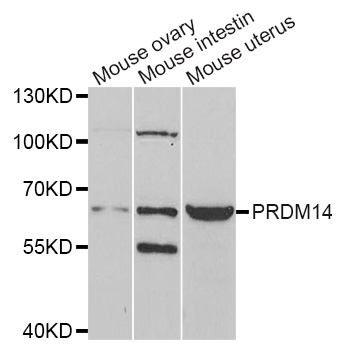 PRDM14 Antibody - Western blot analysis of extracts of various cell lines.