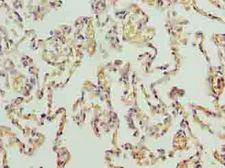PRDM14 Antibody - Immunohistochemistry of paraffin-embedded human lung tissue using antibody at dilution of 1:100.