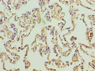 PRDM14 Antibody - Immunohistochemistry of paraffin-embedded human lung tissue using PRDM14 Antibody at dilution of 1:100