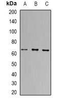PRDM14 Antibody - Western blot analysis of PRDM14 expression in BT474 (A); Jurkat (B); HeLa (C) whole cell lysates.