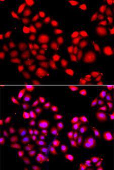 PRDM14 Antibody - Immunofluorescence analysis of A549 cells using PRDM14 antibody. Blue: DAPI for nuclear staining.