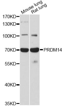 PRDM14 Antibody - Western blot analysis of extracts of various cell lines, using PRDM14 antibody at 1:1000 dilution. The secondary antibody used was an HRP Goat Anti-Rabbit IgG (H+L) at 1:10000 dilution. Lysates were loaded 25ug per lane and 3% nonfat dry milk in TBST was used for blocking. An ECL Kit was used for detection and the exposure time was 90s.