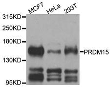 PRDM15 Antibody - Western blot analysis of extracts of various cell lines.