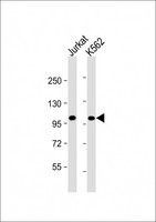 PRDM16 Antibody - All lanes: Anti-PRDM16 Antibody at 1:4000 dilution Lane 1: Jurkat whole cell lysate Lane 2: K562 whole cell lysate Lysates/proteins at 20 µg per lane. Secondary Goat Anti-mouse IgG, (H+L), Peroxidase conjugated at 1/10000 dilution. Predicted band size: 140 kDa Blocking/Dilution buffer: 5% NFDM/TBST.