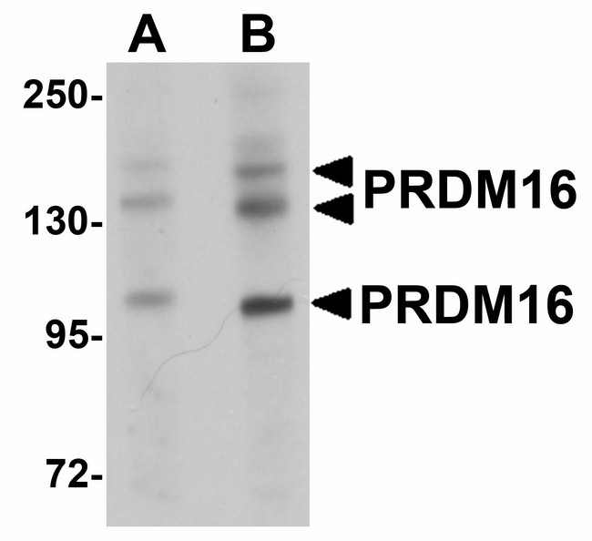 PRDM16 Antibody - Western blot of PRDM16 in rat brain tissue lysate with PRDM16 antibody at (A) 1 and (B) 2 ug/ml.