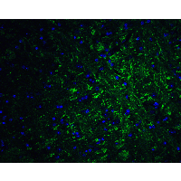 PRDM16 Antibody - Immunofluorescence of PRDM16 in mouse brain tissue with PRDM16 antibody at 20 µg/ml.