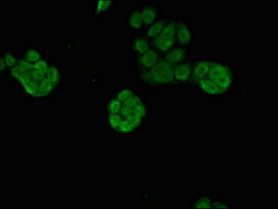 PRDM16 Antibody - Immunofluorescent analysis of PC3 cells diluted at 1:100 and Alexa Fluor 488-congugated AffiniPure Goat Anti-Rabbit IgG(H+L)