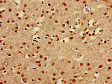 PRDM16 Antibody - Immunohistochemistry of paraffin-embedded human brain tissue at dilution of 1:100