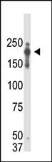 PRDM2 / RIZ1 Antibody - Western blot of anti-PRDM2 antibody in lysate from PRDM2 transgenic lysate.Secondary HRP-anti-mouse was used for signal visualization with chemiluminescence.