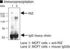 PRDM2 / RIZ1 Antibody