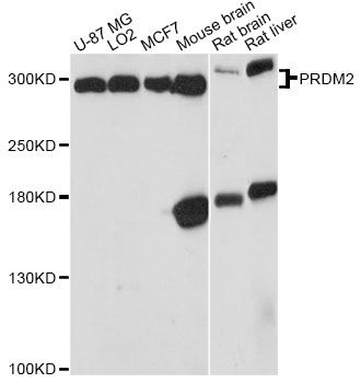 PRDM2 / RIZ1 Antibody - Western blot analysis of extracts of various cell lines, using PRDM2 antibody at 1:3000 dilution. The secondary antibody used was an HRP Goat Anti-Rabbit IgG (H+L) at 1:10000 dilution. Lysates were loaded 25ug per lane and 3% nonfat dry milk in TBST was used for blocking. An ECL Kit was used for detection and the exposure time was 90s.