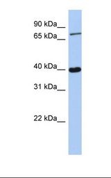 PRDM4 Antibody - 721_B cell lysate. Antibody concentration: 1.0 ug/ml. Gel concentration: 12%.  This image was taken for the unconjugated form of this product. Other forms have not been tested.