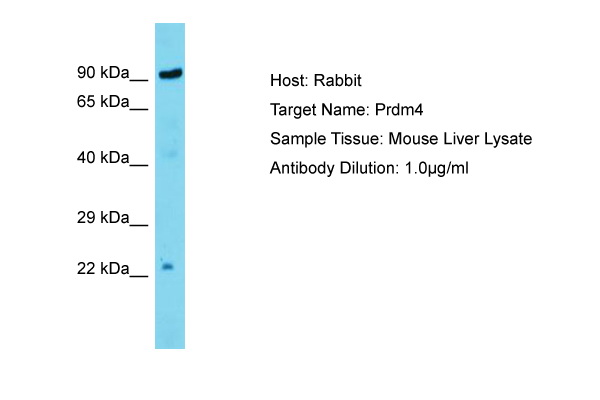 PRDM4 Antibody -  This image was taken for the unconjugated form of this product. Other forms have not been tested.