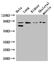 PRDM4 Antibody - Western Blot Positive WB detected in: Hela whole cell lysate, Mouse lung tissue, Mouse kidney tissue, Mouse skeletal muscle tissue All lanes: PRDM4 antibody at 3.4µg/ml Secondary Goat polyclonal to rabbit IgG at 1/50000 dilution Predicted band size: 88 kDa Observed band size: 88, 70 kDa