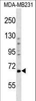 PRDM5 Antibody - PRDM5 Antibody western blot of MDA-MB231 cell line lysates (35 ug/lane). The PRDM5 antibody detected the PRDM5 protein (arrow).