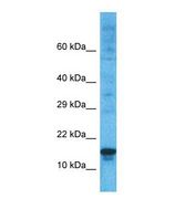 PRDM5 Antibody - Western blot of Human ACHN. PRDM5 antibody dilution 1.0 ug/ml.  This image was taken for the unconjugated form of this product. Other forms have not been tested.