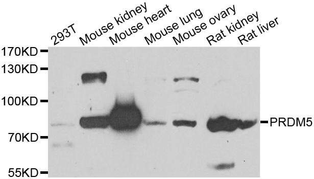 PRDM5 Antibody - Western blot of extracts of various cell lines, using PRDM5 antibody.