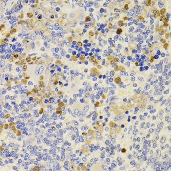 PRDM5 Antibody - Immunohistochemistry of paraffin-embedded rat spleen tissue.