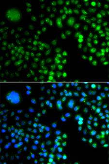PRDM5 Antibody - Immunofluorescence analysis of A549 cells.