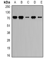 PRDM5 Antibody - Western blot analysis of PRDM5 expression in HEK293T (A); mouse heart (B); mouse lung (C); rat kidney (D); rat liver (E) whole cell lysates.