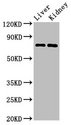 PRDM5 Antibody - Positive Western Blot detected in Mouse liver tissue, Mouse kidney tissue. All lanes: PRDM5 antibody at 3 µg/ml Secondary Goat polyclonal to rabbit IgG at 1/50000 dilution. Predicted band size: 74, 70, 13, 59 KDa. Observed band size: 74 KDa