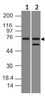 PRDM5 Antibody - Fig-1: Western blot analysis of PRDM5. Anti- PRDM5 antibody was used at 2 µg/ml on (1) HepG2 and (2) PC3 lysates.
