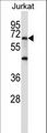 PRDM6 Antibody - PRDM6 Antibody western blot of Jurkat cell line lysates (35 ug/lane). The PRDM6 antibody detected the PRDM6 protein (arrow).