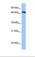 PRDM6 Antibody - Jurkat cell lysate. Antibody concentration: 1.0 ug/ml. Gel concentration: 12%.  This image was taken for the unconjugated form of this product. Other forms have not been tested.