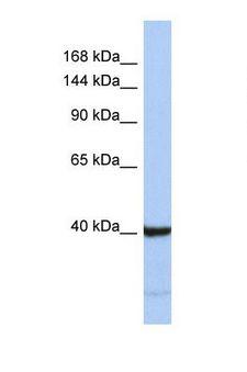 PRDM6 Antibody - Western blot of Human Jurkat. PRDM6 antibody dilution 1.0 ug/ml.  This image was taken for the unconjugated form of this product. Other forms have not been tested.