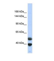 PRDM7 Antibody - Western blot of Human Fetal Lung. PRDM7 antibody dilution 1.0 ug/ml.  This image was taken for the unconjugated form of this product. Other forms have not been tested.