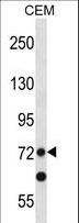 PRDM8 Antibody - PRDM8 Antibody western blot of CEM cell line lysates (35 ug/lane). The PRDM8 antibody detected the PRDM8 protein (arrow).