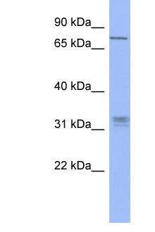 PRDM8 Antibody - PRDM8 antibody Western blot of Mouse Thymus lysate. Antibody concentration 1 ug/ml. This image was taken for the unconjugated form of this product. Other forms have not been tested.