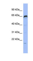 PRDM8 Antibody - PRDM8 antibody Western blot of HT1080 cell lysate. This image was taken for the unconjugated form of this product. Other forms have not been tested.
