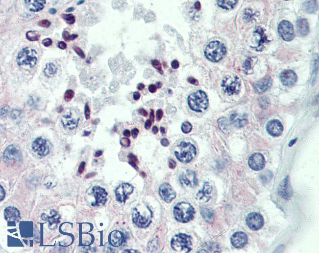PRDM9 Antibody - Anti-PRDM9 antibody IHC of human testis. Immunohistochemistry of formalin-fixed, paraffin-embedded tissue after heat-induced antigen retrieval. Antibody concentration 5 ug/ml.  This image was taken for the unconjugated form of this product. Other forms have not been tested.