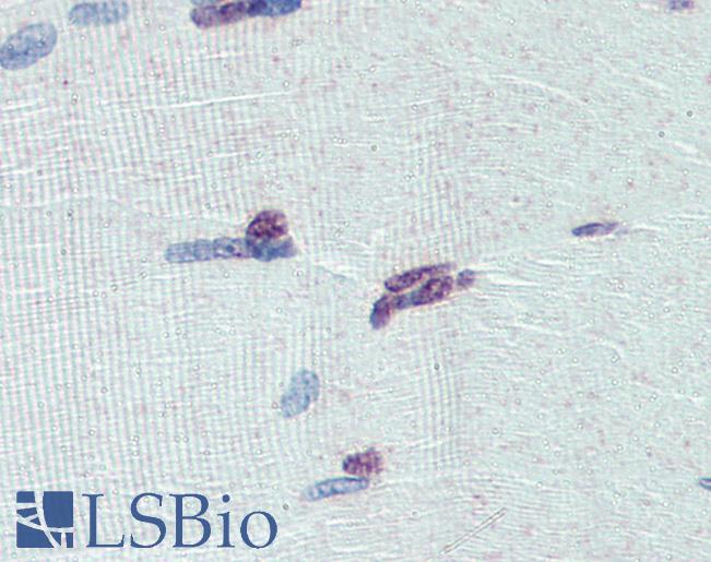 PRDM9 Antibody - Anti-PRDM9 antibody IHC of human skeletal muscle. Immunohistochemistry of formalin-fixed, paraffin-embedded tissue after heat-induced antigen retrieval. Antibody concentration 5 ug/ml.  This image was taken for the unconjugated form of this product. Other forms have not been tested.