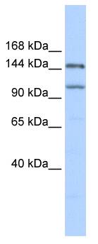 PRDM9 Antibody - Western blot of 293T cell lysate.  This image was taken for the unconjugated form of this product. Other forms have not been tested.