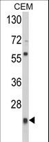 PRDX1 / Peroxiredoxin 1 Antibody - Western blot of PRDX1 Antibody in CEM cell line lysates (35 ug/lane). PRDX1 (arrow) was detected using the purified antibody.