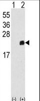 PRDX1 / Peroxiredoxin 1 Antibody - Western blot of PRDX1 (arrow) using rabbit polyclonal PRDX1 Antibody. 293 cell lysates (2 ug/lane) either nontransfected (Lane 1) or transiently transfected with the PRDX1 gene (Lane 2).