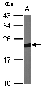 PRDX1 / Peroxiredoxin 1 Antibody - Sample (30 ug of whole cell lysate). A: NIH-3T3 12% SDS PAGE. PRDX1 antibody diluted at 1:1000.